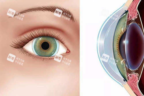 北京维视眼科能换眼角膜吗？价格多少钱？北京维视眼科医院怎么样？地址在哪个区？