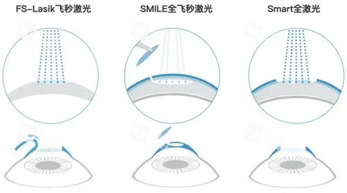 激光的种类区别