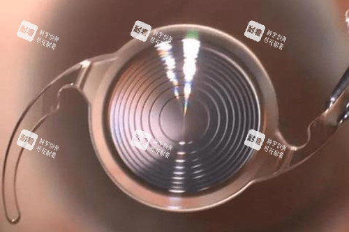 白内障晶体图片