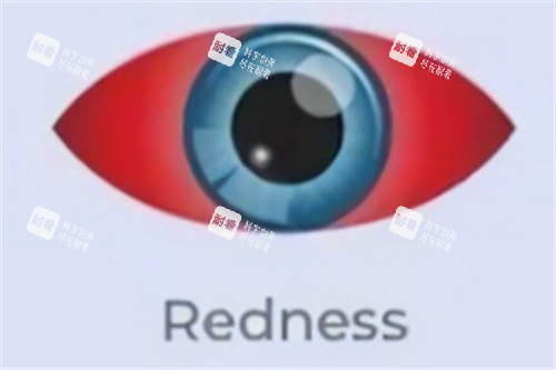 干眼症眼睛红肿