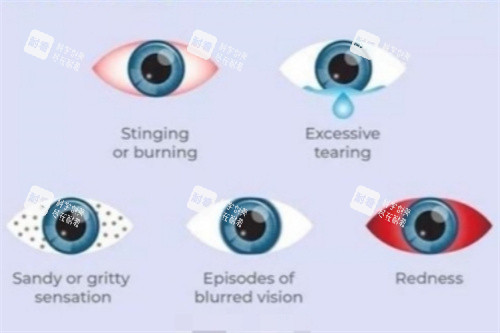 干眼症五种常见症状