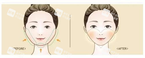 朱乐林磨骨究竟贵不贵?一份说透价格与价值的诚意账单