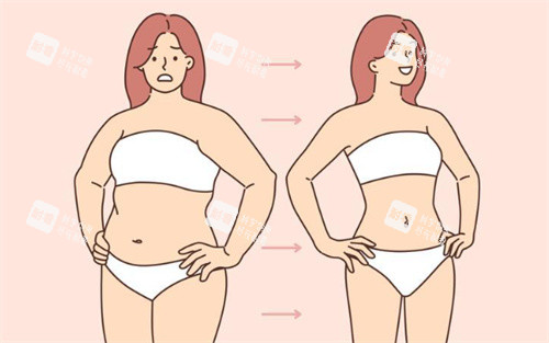 吸脂卡通 吸脂卡通