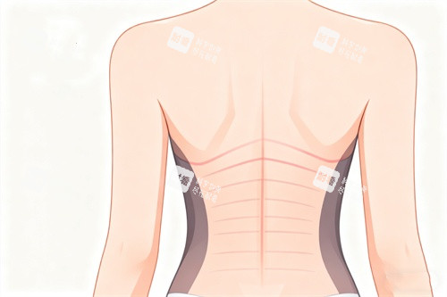 背部吸脂塑形卡通图 背部吸脂塑形卡通图