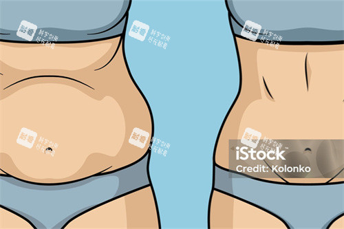 产后吸脂展示图 产后吸脂展示图