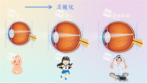近视眼镜轴长与年龄变化示意图