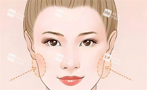 面部两侧凹陷 面部两侧凹陷