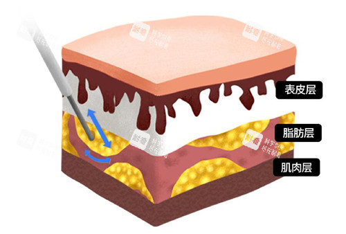 脂肪层次位置示意图 脂肪层次位置示意图