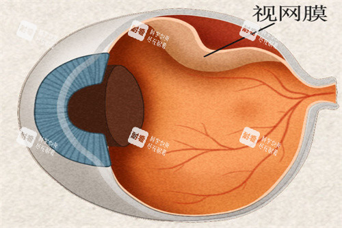 视网膜概念图