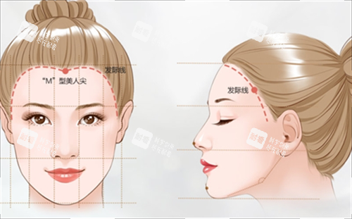 M型发际线素材 M型发际线素材