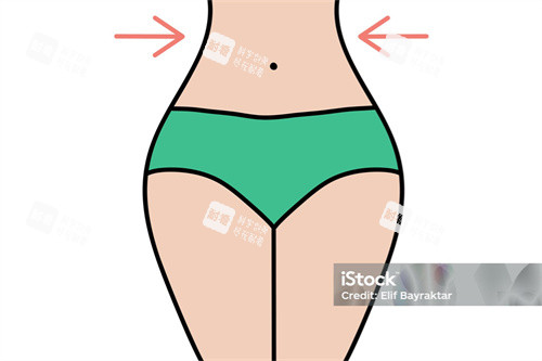 腰腹吸脂展示 腰腹吸脂展示