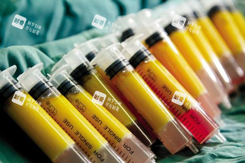 自体脂肪丰胸脂肪