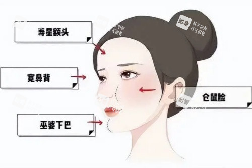 面部馒化卡通图