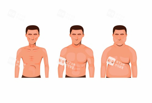 男性乳房发育吸脂后图片示意图 男性乳房发育吸脂后图片示意图