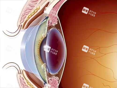 割眼角膜手术眼部侧面透视图