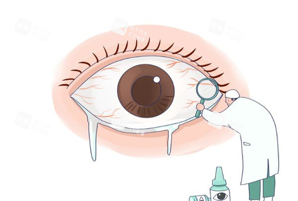 眼角膜治疗卡通图