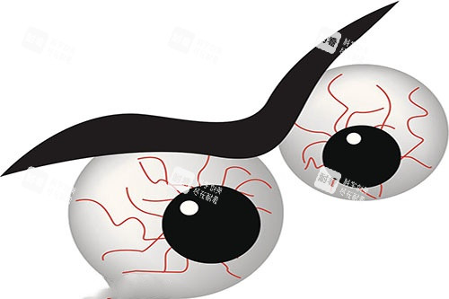 眼睛充血图片展示