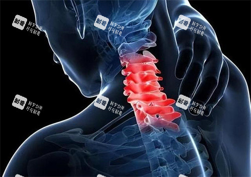 脊椎压迫神经的示意图