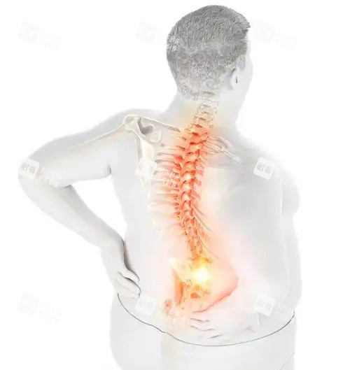 脊椎压迫神经的动画图