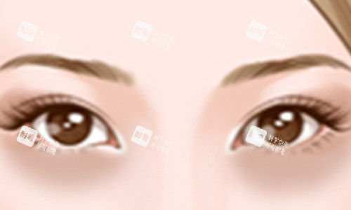 黑眼圈位置展示