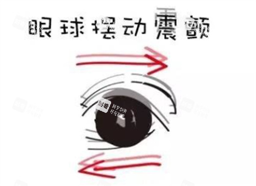 眼球震颤的现象