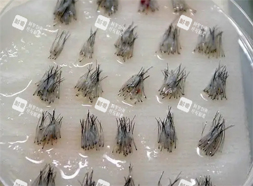 毛囊照片 毛囊照片