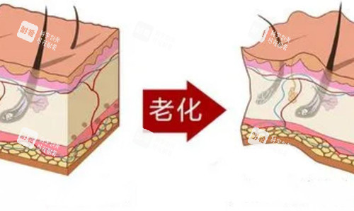 皮肤老化对比卡通示意图 皮肤老化对比卡通示意图