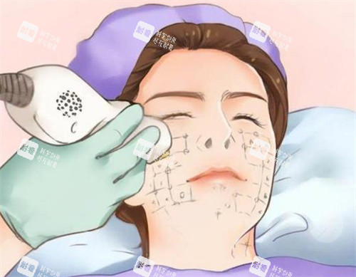 热玛吉卡通图片 热玛吉卡通图片