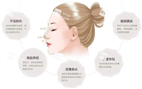 亲测有效！徐永丰医生隆鼻怎么预约？三招快速锁定号源，提前排期不跑空！妈生自然鼻口碑爆棚