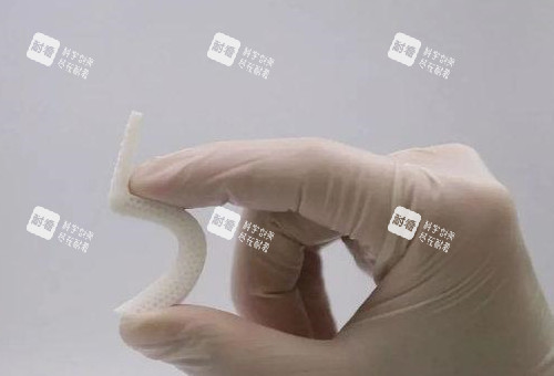 超体隆鼻照片展示图 超体隆鼻照片展示图