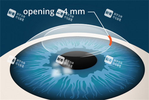2026湖北省第三人民医院眼科预约挂号流程+医生排班，近视矫正/白内障一站式挂号