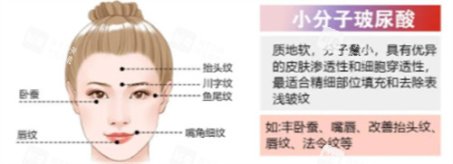 小分子玻尿酸简介 小分子玻尿酸简介