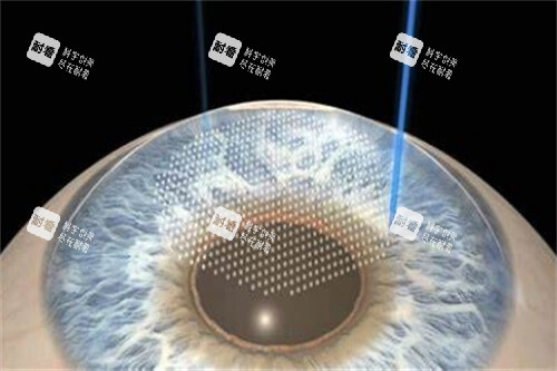 武汉同济医院眼睛激光手术大概要用多少钱？大概2-3万元，全飞秒、半飞秒价格差不少！