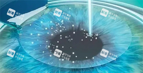 武汉同济医院眼科激光手术怎么样？技术是非常好的，但预约要等半年，值不值得看这篇！