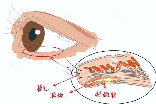郑州王杨医生眼睑外翻矫正手术怎么样?解锁闭眼无忧的钥匙,功能重塑与美学精修的共舞