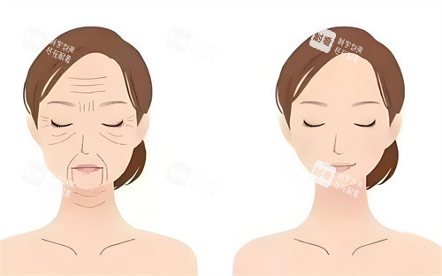 眼袋手术前后对动画图