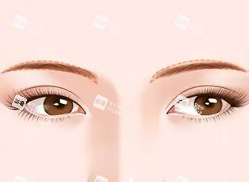 眉毛纹绣卡通示意图