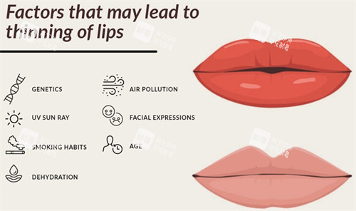 唇部整形手术前后对比 唇部整形手术前后对比