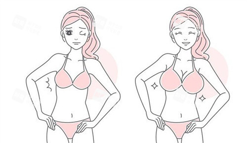 哈尔滨华美整形医院正规吗？双眼皮/隆胸/抗衰项目技术评测！