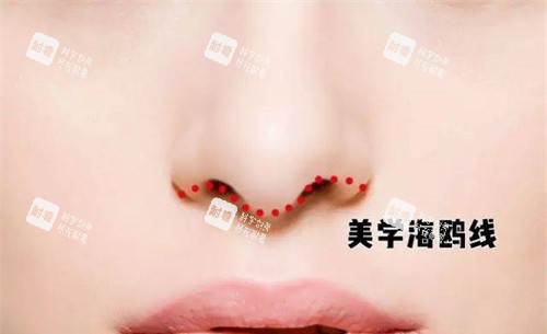 海鸥鼻型展示图 海鸥鼻型展示图