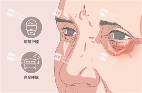 眼部护理 眼部护理