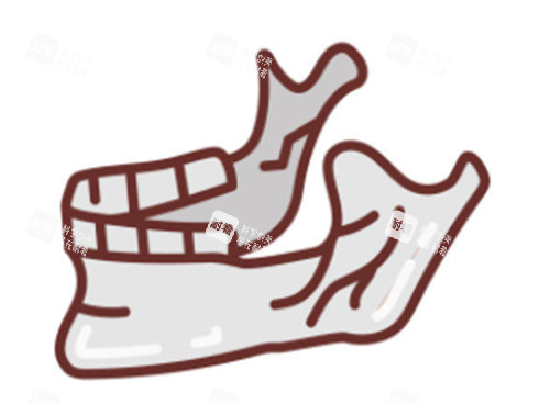 下颌角卡通图 下颌角卡通图