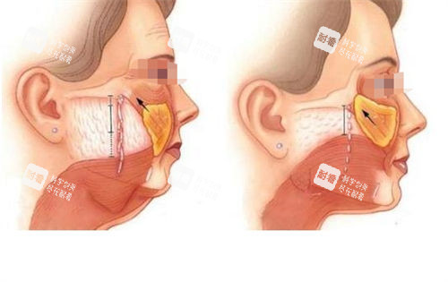 拉皮医生李峰口碑好不好？真实求美者反馈、技术特点、擅长项目多样化分析