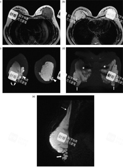 胸部注射不明注射物