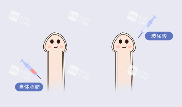 自体脂肪增大增粗照片