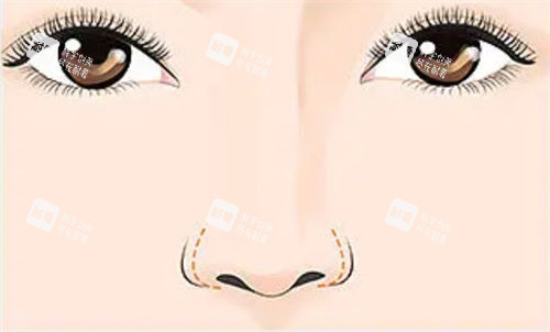 鼻部形态展示图