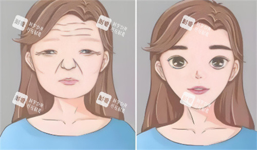 面部抗衰 面部抗衰