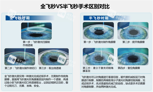 全飞和半飞区别