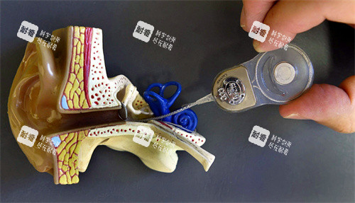 人工耳蜗和耳朵模型