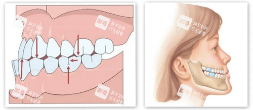 下巴内缩内部展示动画图